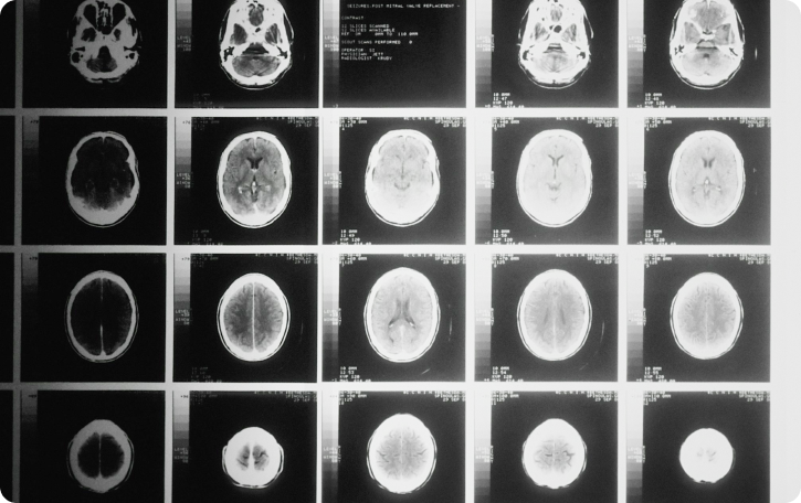 Neurological Care